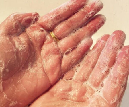 祛斑之后角质层薄如何修复  祛斑 美白祛黄 第4张