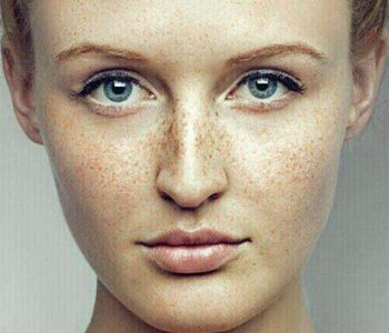 角质层薄可以用淡斑精华吗，举例说明