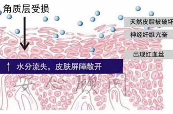 角质层薄可以用淡斑精华吗，举例说明  淡斑精华 美白祛黄 第2张