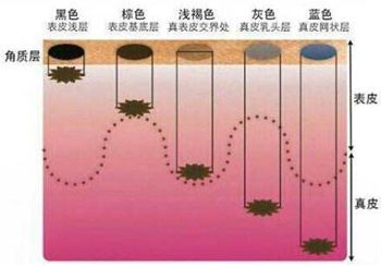 角质层薄可以用淡斑精华吗，举例说明  淡斑精华 美白祛黄 第3张