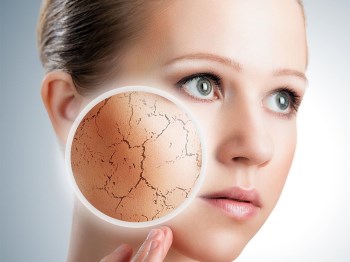 不健康的角质层有哪些表现，别让肌肤受损加重  角质 美白祛黄 第4张