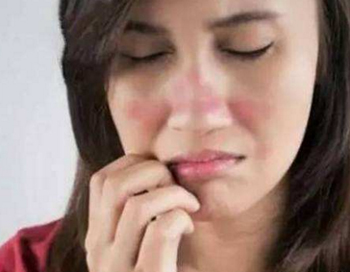 角质层薄能用洁面膏吗，小心毁坏角质层  角质层薄 洁面膏 美白祛黄 第3张