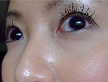 角质层太厚有什么坏处，必看五点  角质层厚 美白祛黄 第5张