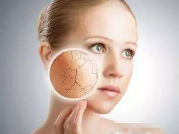 角质层薄能用酒精吗  角质层薄 酒精 美白祛黄 第3张