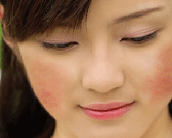 角质层薄能被风吹吗