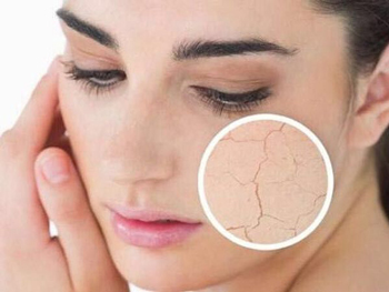 角质层薄能被风吹吗  角质层薄 被风吹 美白祛黄 第2张