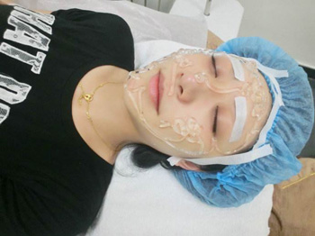 角质层薄能做脉冲光吗