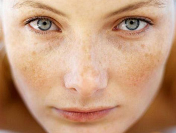 角质层薄能做脉冲光吗  角质层薄 美白祛黄 第2张