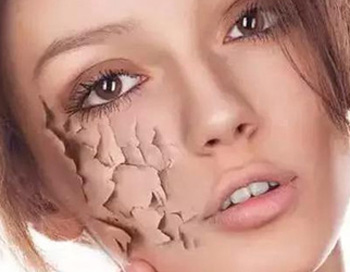 角质层薄的原因，有两种你知道吗？  角质层薄 美白祛黄 第1张