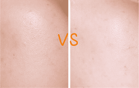 兰芝臻白修护柔肤精华露怎么样，宋慧乔的美白秘密武器  兰芝 精华液 第11张