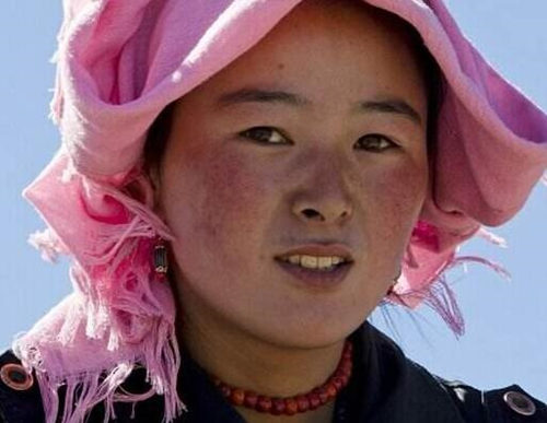 用了护肤品脸上起红血丝是怎么回事，原因分析  护肤品 美白祛黄 第4张