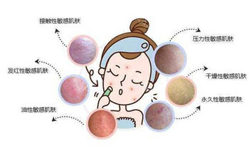 有红血丝就是敏感肌吗，两者有什么区别