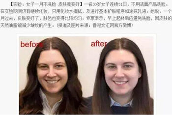 一月不洗脸红血丝好了是真的吗， 