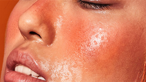 你确定你的脸只是红血丝，而不是玫瑰痤疮  玫瑰痤疮 美白祛黄 第5张