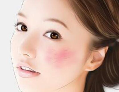 有红血丝的人能蒸桑拿吗，小心谨慎总没错