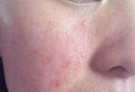 喝茶多了会产生红血丝吗，对皮肤有什么好处和好处  喝茶 美白祛黄 第2张