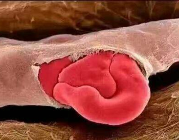 红血丝肌肤如何保养，呵护红血丝要慎重  红血丝 保养 美白祛黄 第4张