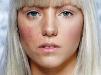 唯恩诗真真老师一对一指导去红血丝