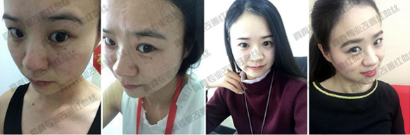 唯恩诗真真老师一对一指导去红血丝  红血丝 一对一 老师 美白祛黄 第2张