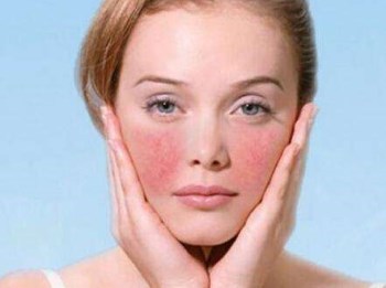 真真老师分享冬季红血丝肌肤护理方法大揭秘  红血丝 肌肤 老师 美白祛黄 第4张