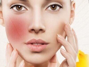 过敏后红血丝能自愈吗，肌肤护理方法怎么做