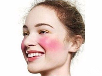 敏感型红血丝皮肤如何护理方法介绍  红血丝 皮肤 美白祛黄 第4张