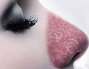 红血丝危害，了解红血丝问题严重性