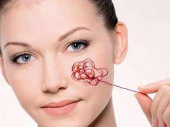 有红血丝属于什么皮肤  红血丝 美白祛黄 第3张