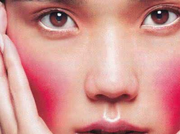 有红血丝属于什么皮肤  红血丝 美白祛黄 第4张