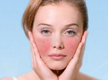 思兰朵红血丝修复乳怎么样