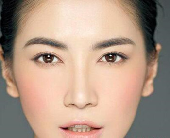 脸上有红血丝是角质层薄吗，如何改善