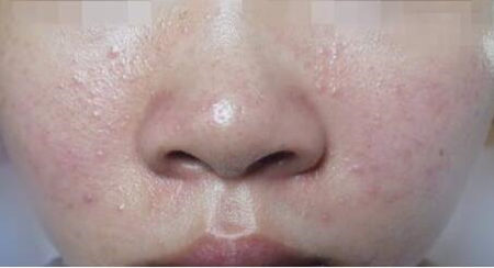 正常肤质用敏感肌的护肤品行么  正常肤质 美白祛黄 第3张