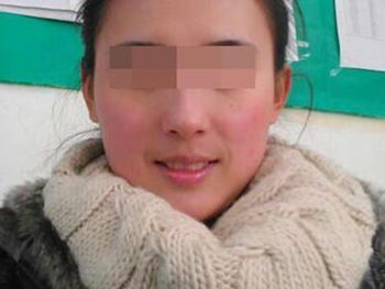 医院能修复敏感肌肤吗