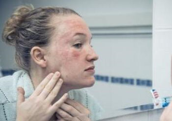 医院能修复敏感肌肤吗  医院 美白祛黄 第2张