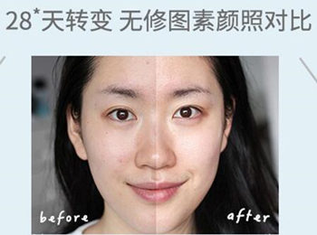 欧莱雅小白瓶敏感肌可以用吗，适合什么肤质  欧莱雅 小白瓶 美白祛黄 第4张