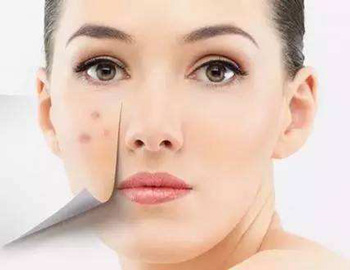 唯恩诗聚能修护精华液，修护红血丝与肌肤屏障  唯恩诗 美白祛黄 第4张