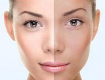 皮肤基底层缺水的症状你知道吗  基底层 症状 皮肤 美白祛黄 第3张