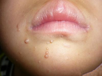 皮肤基底层缺水的症状你知道吗  基底层 症状 皮肤 美白祛黄 第4张