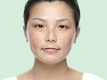 三草两木敏感肌肤能用吗，含有激素吗