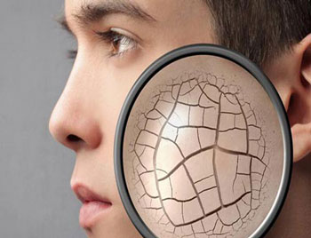 男士敏感肌肤用什么护肤品