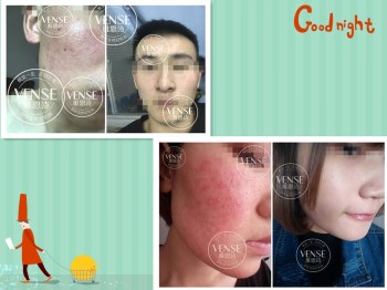 男士敏感肌肤用什么护肤品  男士 敏感肌肤用护肤品 美白祛黄 第9张