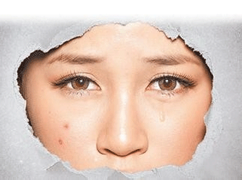 油性敏感肌肤适合什么护肤品