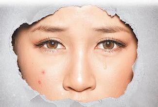 敏感肌肤用什么面膜，苹果肌必备