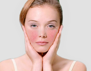 17岁女生敏感肌肤，洗脸后的护肤步骤