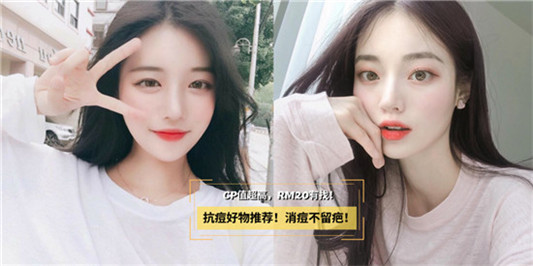 祛痘祛痘印真实历程，我心中的祛痘祛痘印产品排行榜前10名