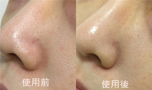 盘点开架医美保养神品，肌肤问题不需要滤镜修修脸  精华液 眼霜 重点保养 改善细纹 美白 改善暗沉 柔嫩 保湿 不黏腻 温和 明亮 服贴 不闷 修饰 不厚重 细纹 敏感 敏感肌推荐 第4张