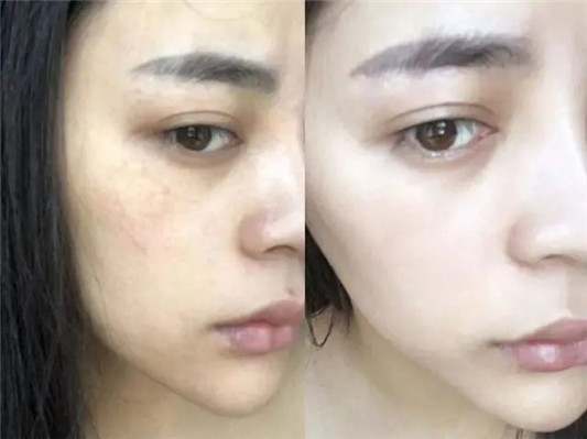 精华液并非越贵越好 屈臣氏有款「平价」精华,紧致嫩白抗衰老 精华 平价 第5张 精华液并非越贵越好 屈臣氏有款「平价」精华,紧致嫩白抗衰老 精华 平价 第5张