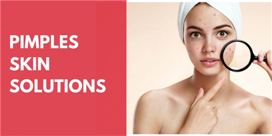 祛痘产品哪个牌子好，真正有效的祛痘产品排行榜10强