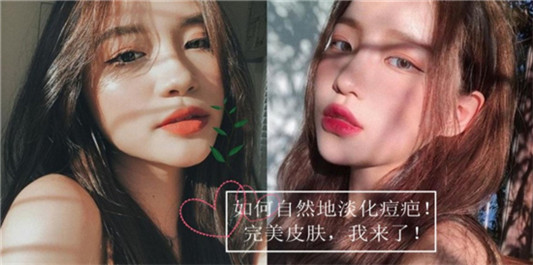 修复痘疤痘印有效产品排行榜10强，持续3年的痘印终于拜拜了