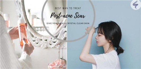 提拉紧致护肤品排行榜，精致V脸细腻肌肤 怎么看都好看